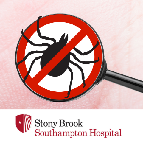 Ticks & Tick-Borne Disease-What You Need to Know!